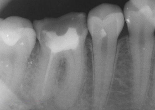 中國再生牙齒研究新進展，重塑微笑，科技引領(lǐng)牙齒再生新篇章