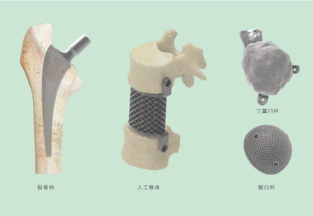 三維打印髖關(guān)節(jié)技術(shù)新動態(tài)，重塑生活的科技魔法奇跡