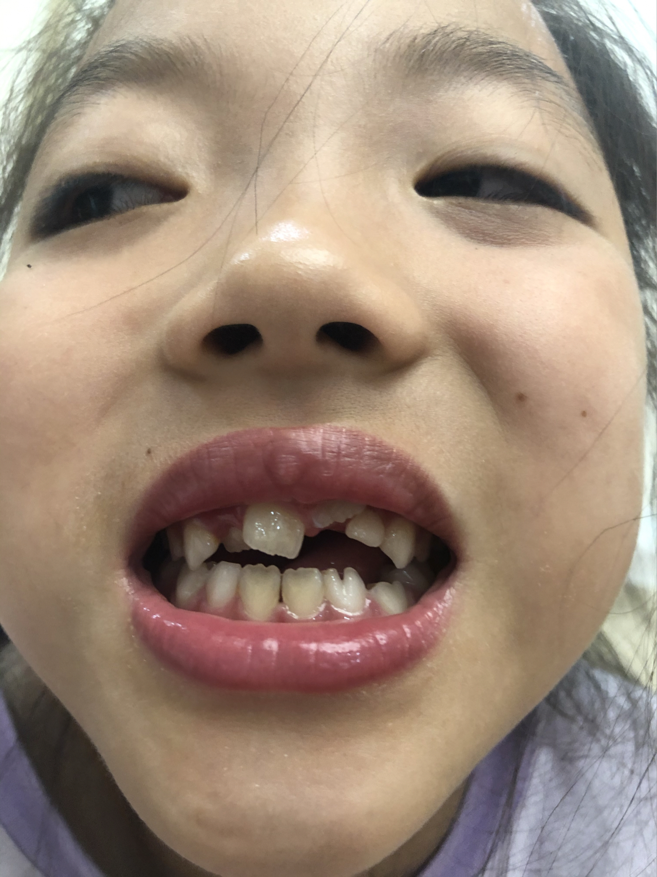 莊最新牙齒技術揭秘，牙齒美容新選擇